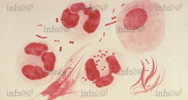 La bactérie responsable de la gonorrhée de plus en plus résistante aux antibiotiques